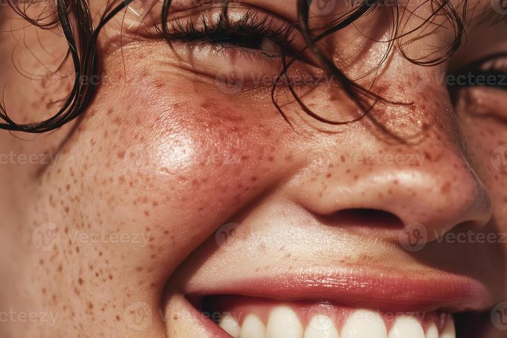 Close-up of a person's face with freckles and a smile.